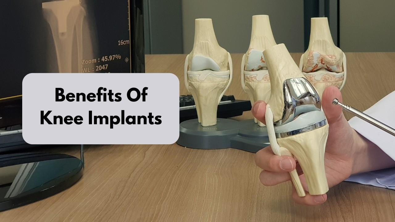 A Beginner’s Guide to Understanding Knee Implant Procedures