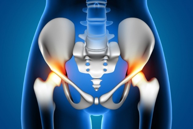 hip replacement surgery benefits