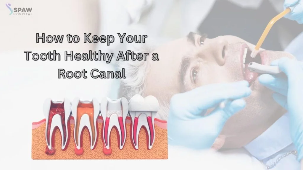 Care after root canal