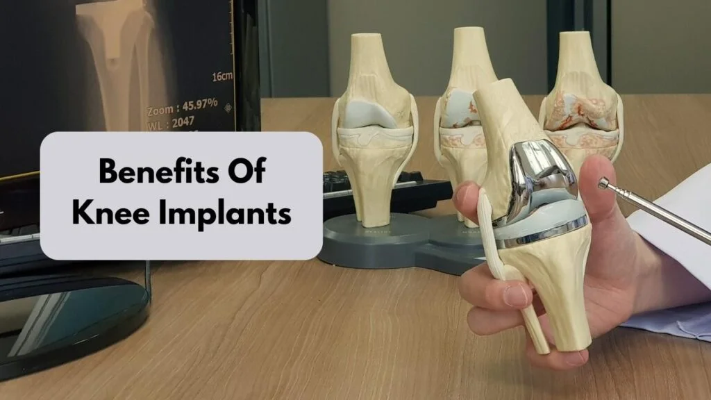 Understanding Knee Implant